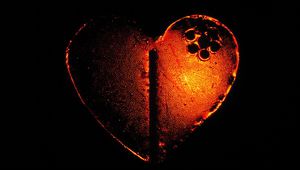 Сърдечен пристъп