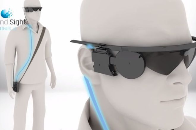 Bionetichnite ochi argus ii