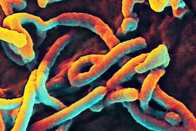 Ebola pod mikroskop