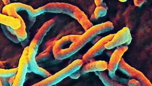 Ебола под микроскоп