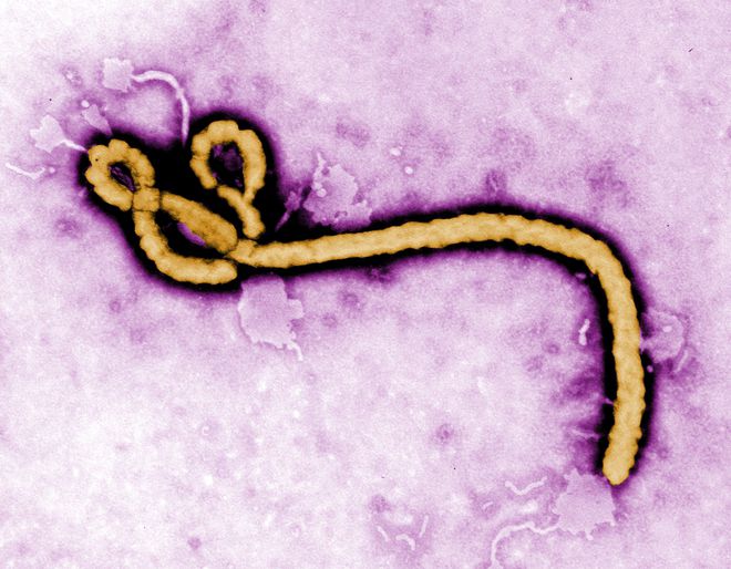 Ебола - вирусът отблизо