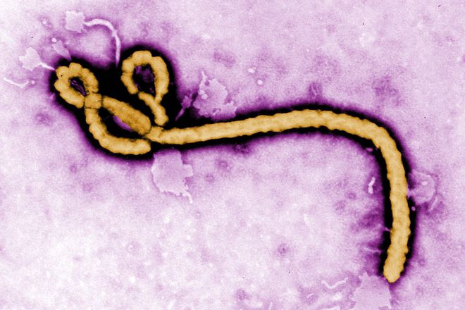 Ebola virusat otblizo