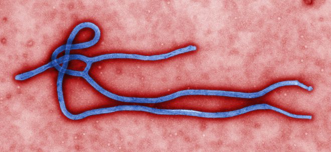Вирусът на еболата под микроскоп