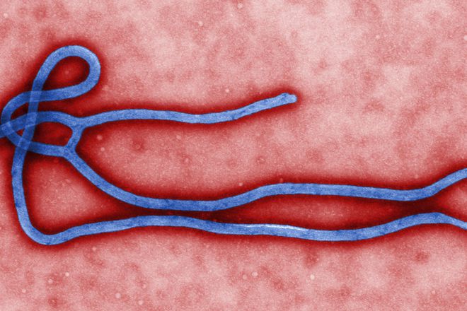 Virusat na ebolata pod mikroskop