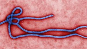 Вирусът на еболата под микроскоп