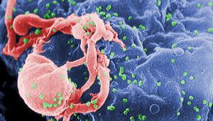 Вирусът HIV-1 под микроскоп