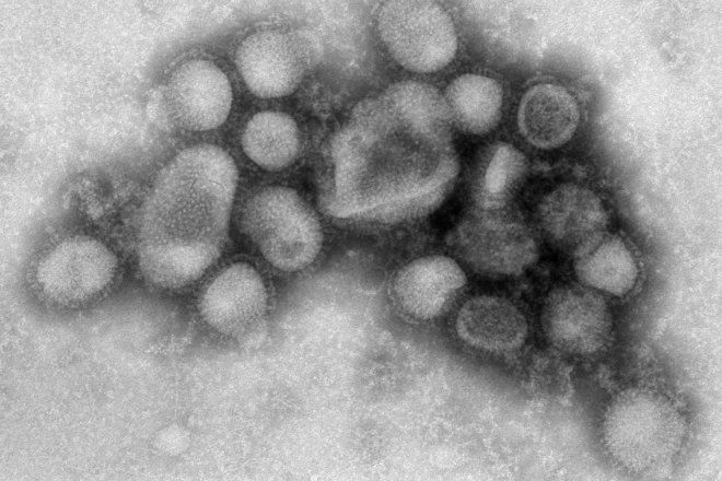 Gripniyat virus h1n1