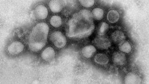Грипният вирус H1N1