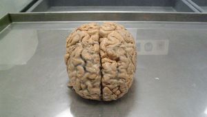 Човешки мозък