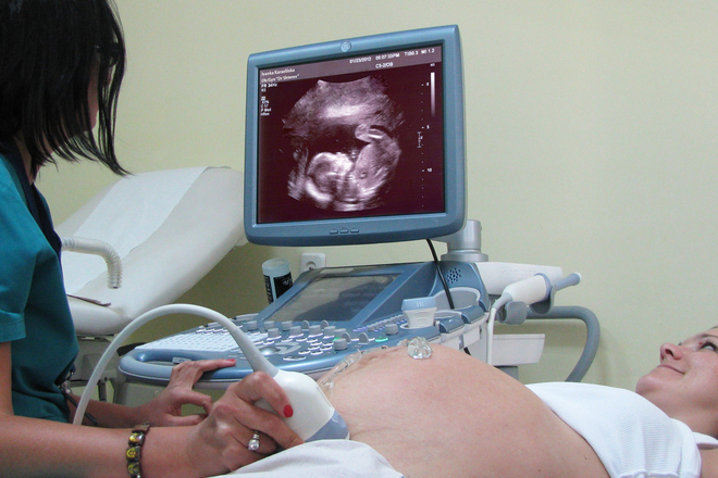 Bremenna zhena na kontrolen pregled