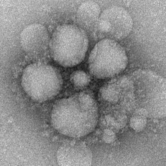 Вирусът на БИРС под микроскоп