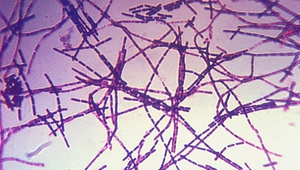 Bacillus anthracis