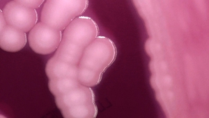 Антраксният бацил под микроскоп