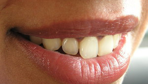 Усмивката е важна