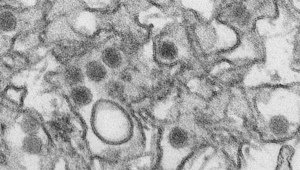 Вирусът Зика