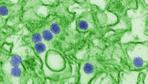 Вирусът Зика под микроскоп