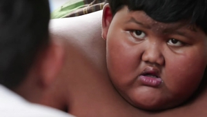 Най-дебелото дете в света