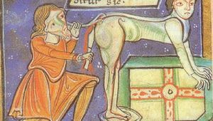 Средновековен метод за премахване на хемороиди