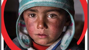 Децата на Сирия страдат и от невидими рани
