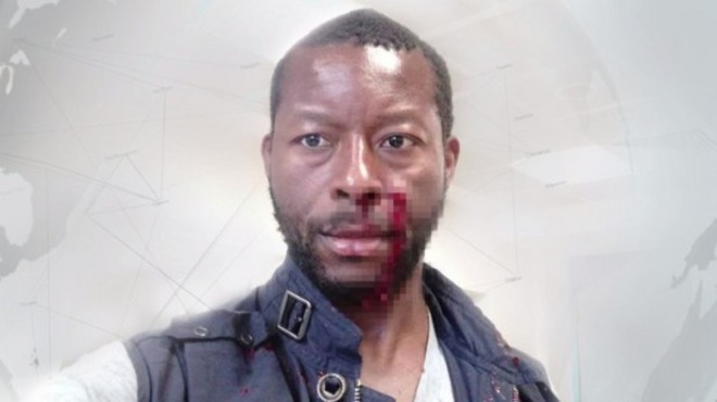 Пребитият в София Окон Анянихи