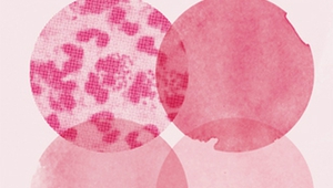 Вирусът на гонореята под микроскоп