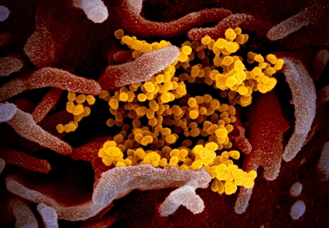Новият коронавирус SARS-CoV-2 под микроскоп
