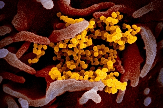 Noviyat koronavirus sars cov 2 pod mikroskop