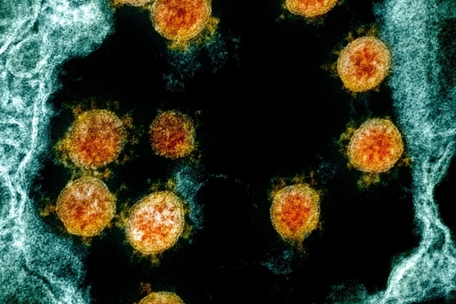 Noviyat koronavirus pod mikroskop