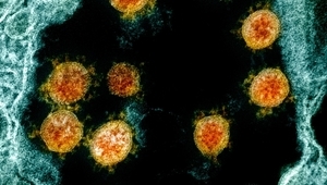 Новият коронавирус под микроскоп