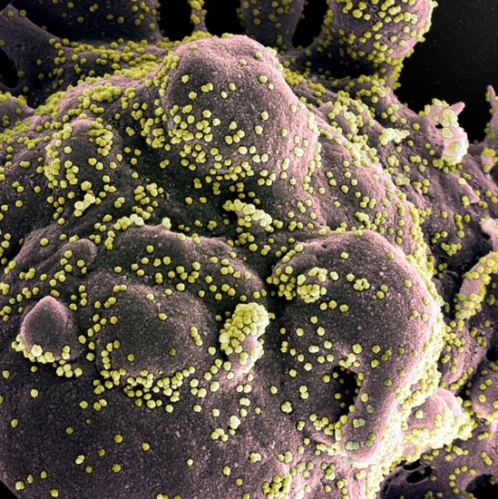 Клетка, заразена с новия коронавирус SARS-CoV-2