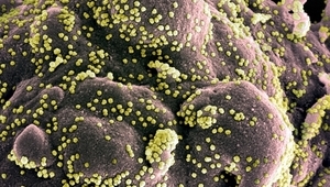 Клетка, заразена с новия коронавирус SARS-CoV-2
